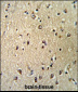 KPNB1 Antibody (N-term)